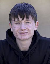 Michael - Male, age 15
